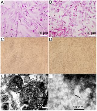 china duck flavivirus disease|Duck egg drop syndrome virus: an emerging Tembusu.